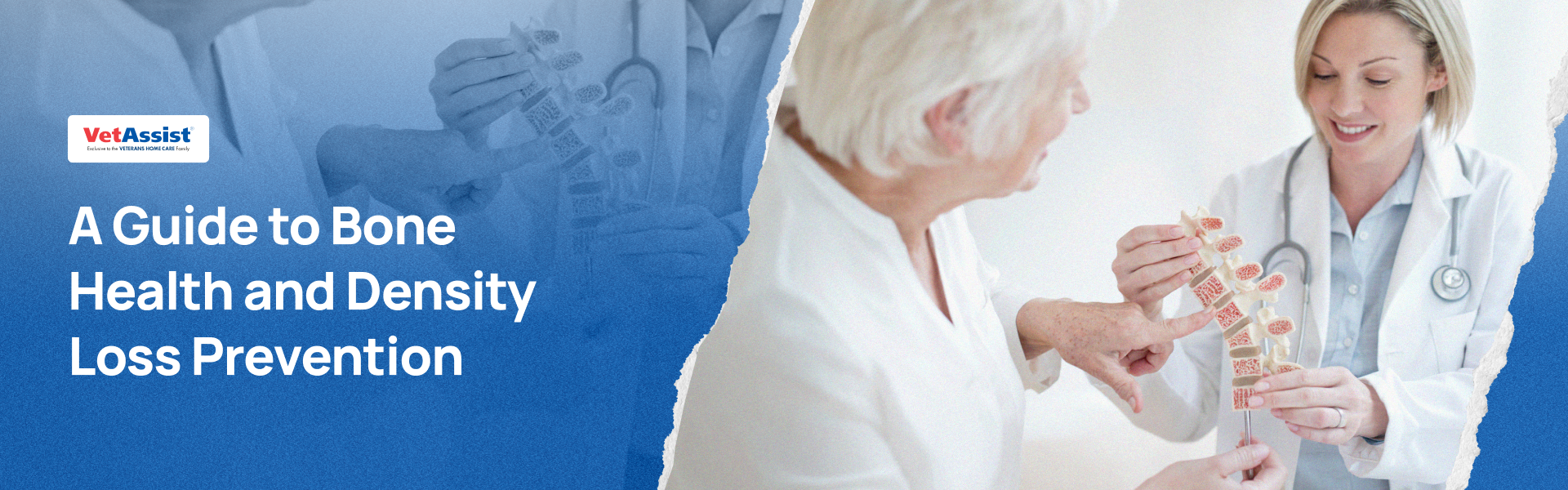A Guide to Bone Health and Density Loss Prevention